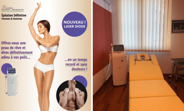 ÉPILATION DÉFINITIVE MONTREUX | Jusqu'à 50%